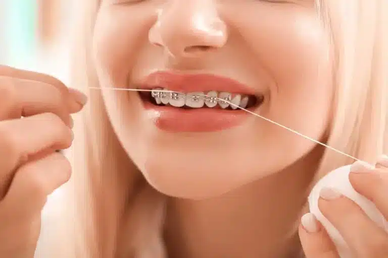 Orthodontics: Your Guide to a Beautiful, Healthy Smile